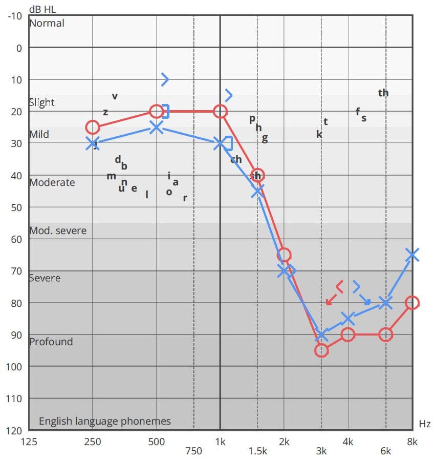 Graph showing a real hearing test and their results